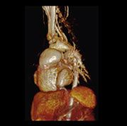 cardiovascular image Appendix video